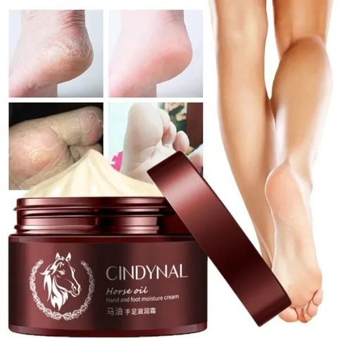 Foot care /Whitening repair foot cream Kem Bôi Ngựa Nứt Gót Chân Nẻ Tay Chân Á Sừng Bong Da Hiệu Quả/110g