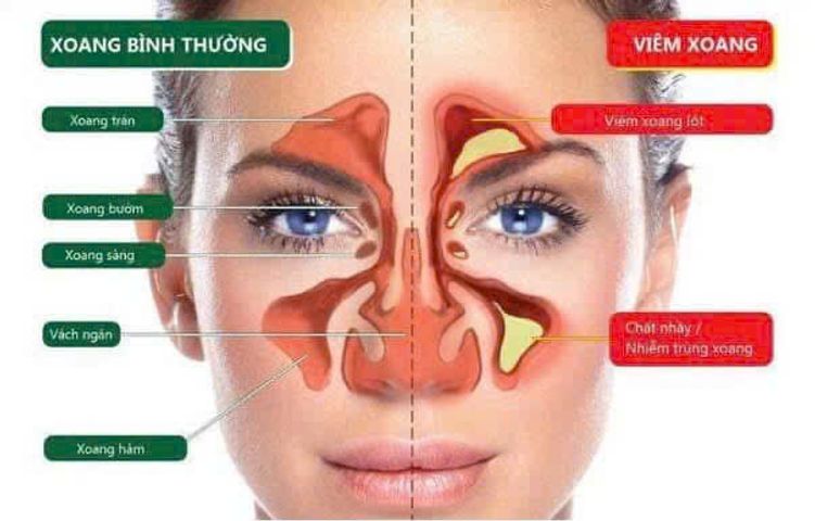 Viên uống SUDAFED PE Pressure + Pain giảm nghẹt mũi, tắc xoang, hạ sốt, giảm đau nhẹ - Hộp 24 viên tiện lợi