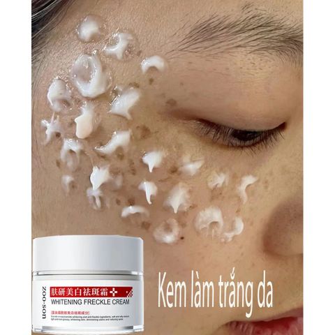 Kem Dưỡng Trắng Da, Hỗ Trợ Làm Mờ Thâm Nám & Đốm Nâu, Cho Da Sáng Đều Màu Rạng Rỡ