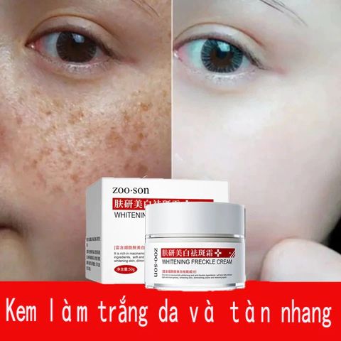 Kem Dưỡng Trắng Da, Hỗ Trợ Làm Mờ Thâm Nám & Đốm Nâu, Cho Da Sáng Đều Màu Rạng Rỡ