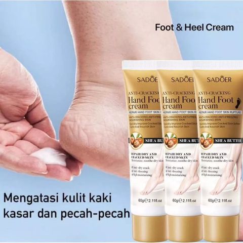 Kem nứt gót chân kem bôi nứt gót chân Kem Dưỡng Ẩm Chống Nứt Nẻ Gót Chân