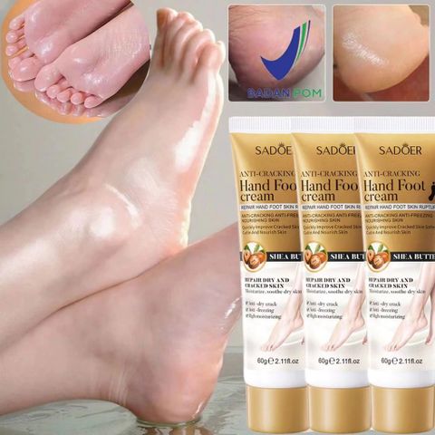 Kem nứt gót chân kem bôi nứt gót chân Kem Dưỡng Ẩm Chống Nứt Nẻ Gót Chân
