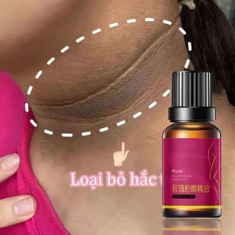 Tinh dầu tẩy trắng da dưỡng ẩm Tinh dầu làm trắng vùng da dưới cánh tay Vùng kín Làm trắng đầu gối/khuỷu tay