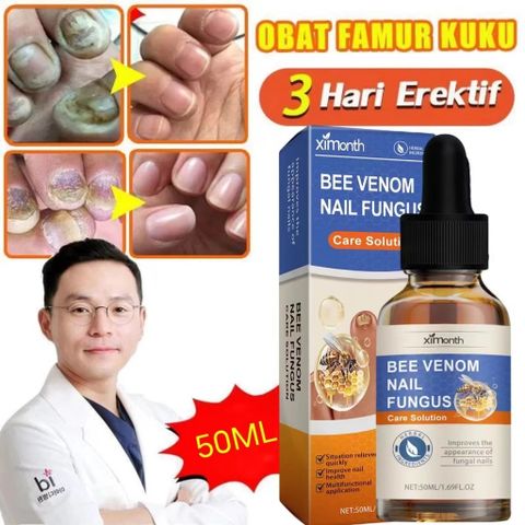 Tinh chất loại bỏ nấm móng Tinh chất bôi móng phục hồi giảm nấm 50ML