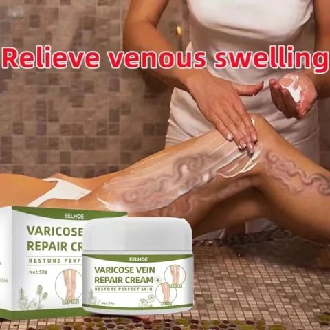  Kem suy giãn tĩnh mạch 50g giúp giảm đau mỏi tê phù chuột rút do suy giãn tĩnh mạch