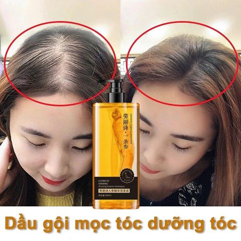 Dầu gội NHÂN SÂM tươi mọc tóc dầu gội chống rụng tóc300ml giảm rụng tóc Mọc Tóc Nhanh kiểm soát Làm mới và kiểm soát dầu