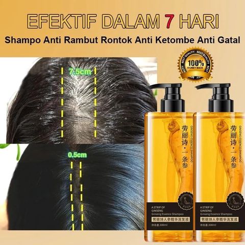 Dầu gội NHÂN SÂM tươi mọc tóc dầu gội chống rụng tóc300ml giảm rụng tóc Mọc Tóc Nhanh kiểm soát Làm mới và kiểm soát dầu