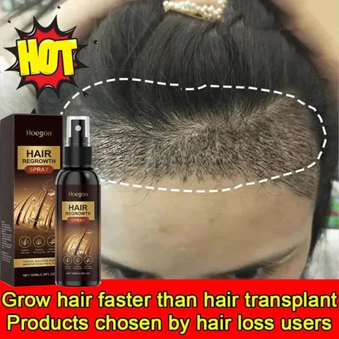 Xịt Kích Thích Mọc Tóc Nhanh 100ML- Phục Hồi Nang Tóc, Giảm Rụng Tóc
