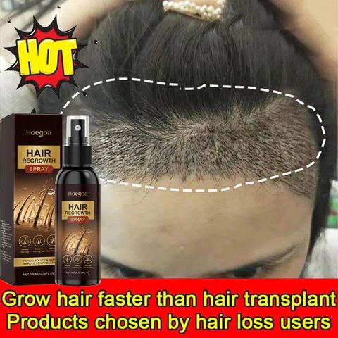 Xịt Kích Thích Mọc Tóc Nhanh 100ML- Phục Hồi Nang Tóc, Giảm Rụng Tóc