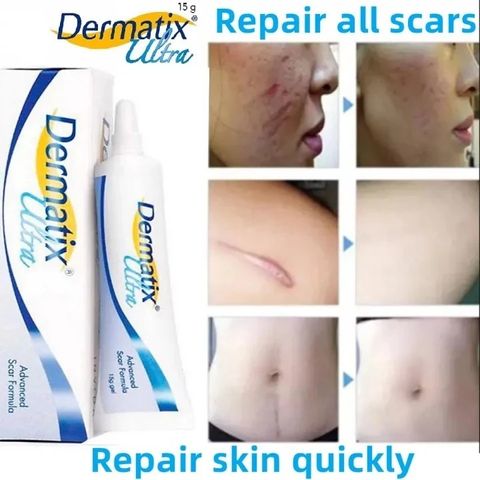 15g Kem Xóa Sẹo Gel Kem Xóa Vết Rạn Da Kem Phục Hồi Vết Bỏng Làm Mịn Da Làm