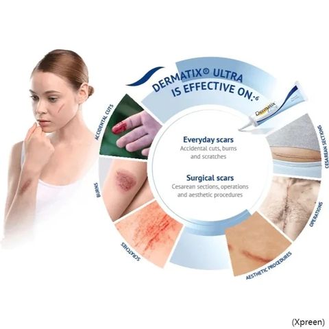 15g Kem Xóa Sẹo Gel Kem Xóa Vết Rạn Da Kem Phục Hồi Vết Bỏng Làm Mịn Da Làm