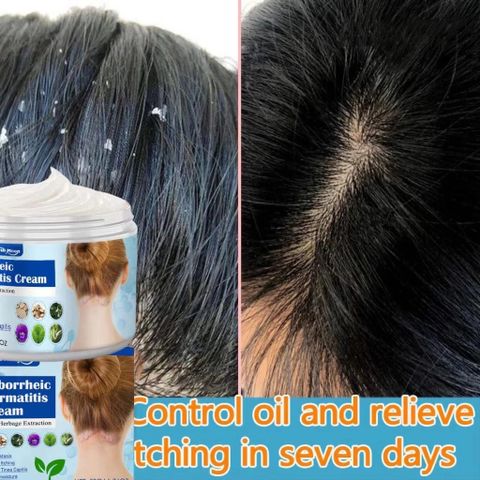 Kem Bôi Nấm Ngứa Viêm Da Cơ Địa NHẬT BẢN Hắc Lào, Tổ Đỉa, Vẩy Nến, Á Sừng, Lang Ben Hiệu Quả