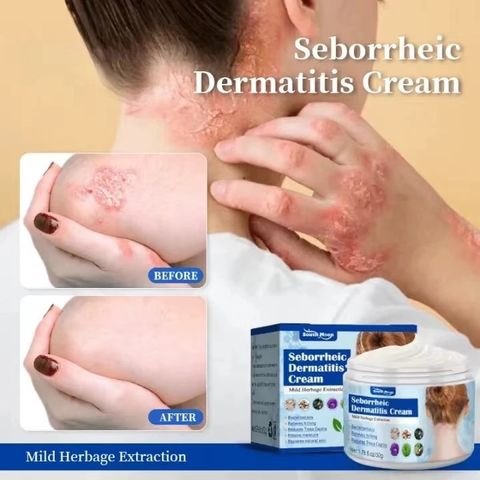 Kem Bôi Nấm Ngứa Viêm Da Cơ Địa NHẬT BẢN Hắc Lào, Tổ Đỉa, Vẩy Nến, Á Sừng, Lang Ben Hiệu Quả