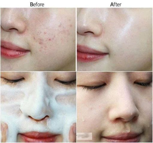 Sữa Rửa Mặt Neutrogena Oil-Free Acne Wash 269ml - Kiềm Dầu, Ngừa Mụn Hiệu Quả, Sản Phẩm Chăm Sóc Da Tốt Vượt Trội