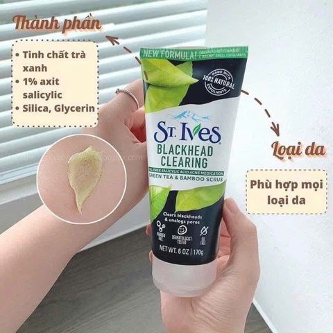 Sữa Rửa Mặt St.Ives Trà Xanh 170g - Loại Bỏ Mụn Đầu Đen, Làm Dịu Da, Chăm Sóc Da Hàng Ngày