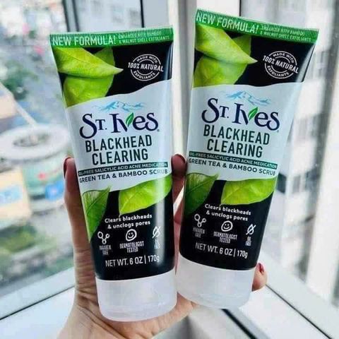Sữa Rửa Mặt St.Ives Trà Xanh 170g - Loại Bỏ Mụn Đầu Đen, Làm Dịu Da, Chăm Sóc Da Hàng Ngày