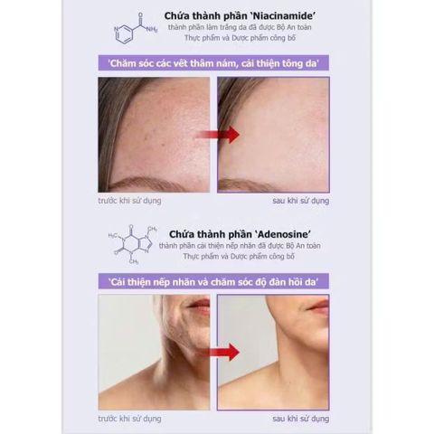 (CHÍNH HÃNG) Kem Dưỡng Da DLK Azulene Ampoule Cream Hỗ Trợ Phục Hồi Và Làm Dịu Da Nhạy Cảm - 50g