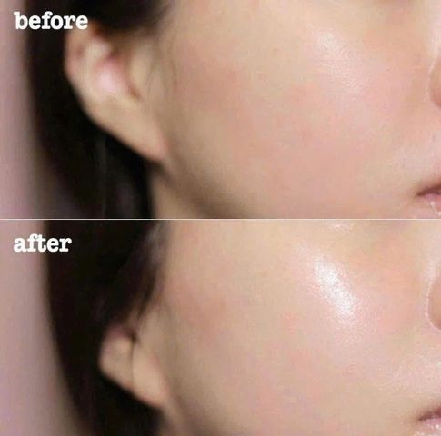 Kem Dưỡng Ẩm Clinique Moisture Surge 100H 50ml - Cấp Ẩm Sâu, Phục Hồi Da, Chăm Sóc Da Mặt Tuyệt Vời