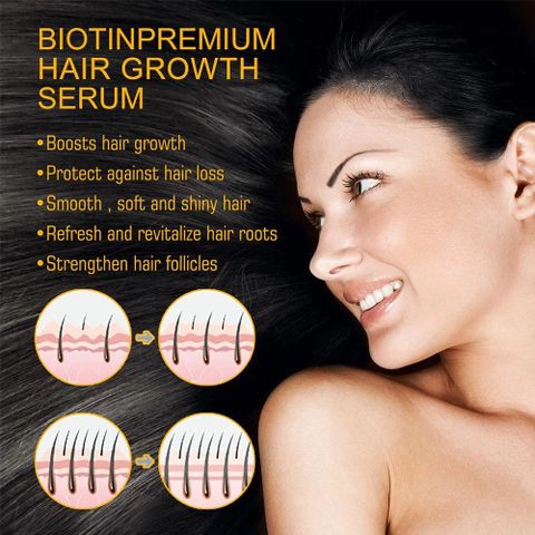 kích thích mọc tóc Xịt mọc tóc Giảm Gãy Rụng nơi rụng tóc Nhanh kiểm soát dầu loại bỏ gàu