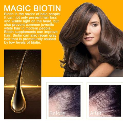 kích thích mọc tóc Xịt mọc tóc Giảm Gãy Rụng nơi rụng tóc Nhanh kiểm soát dầu loại bỏ gàu