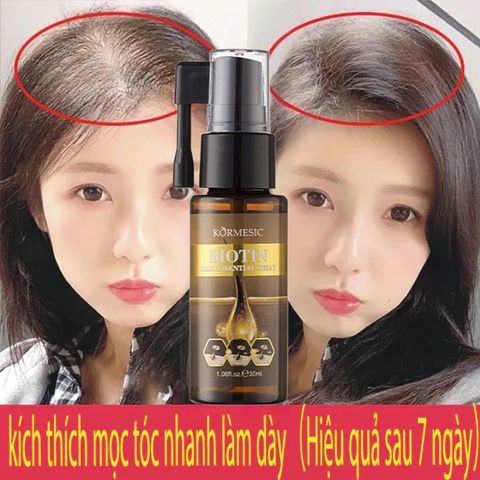 kích thích mọc tóc Xịt mọc tóc Giảm Gãy Rụng nơi rụng tóc Nhanh kiểm soát dầu loại bỏ gàu