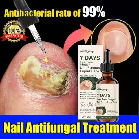 Serum Tẩy Nấm Móng Tay Chân Thảo Mộc Giúp Loại Bỏ Nấm, Kháng Khuẩn, Phục Hồi Móng Cứng Chắc Khỏe Tràm Trà & Gừng 7 DAYS