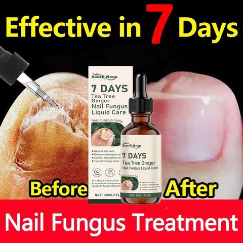 Serum Tẩy Nấm Móng Tay Chân Thảo Mộc Giúp Loại Bỏ Nấm, Kháng Khuẩn, Phục Hồi Móng Cứng Chắc Khỏe Tràm Trà & Gừng 7 DAYS