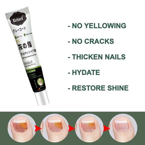 Kem bôi nấm móng tay Nhật Bản 20G