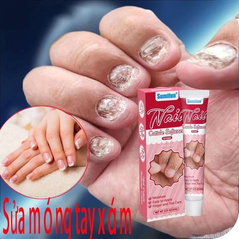 Dưỡng Móng Tay Chân Độc Quyền Thiên Di Dưỡng Cứng Móng Giúp Móng Nhanh Dài, Khoẻ, Bóng, Hồng