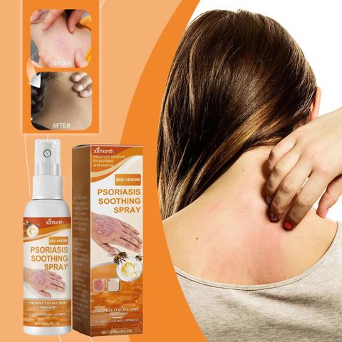 Xịt Da Liễu Hỗ Trợ Vảy Nến, Viêm Da Cơ Địa, Chàm Da, Da Tiết Bã, Nấm Da, Hắc Lào, Á Sừng