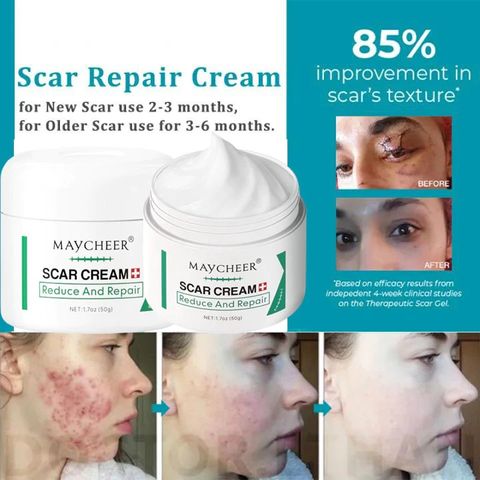 Kem Sẹo MAYCHEER Kem Xoá Sẹo Hỗ Trợ Xóa Mờ Sẹo Lồi, Lõm, Bỏng Bô, Thủy Đậu hiệu quả