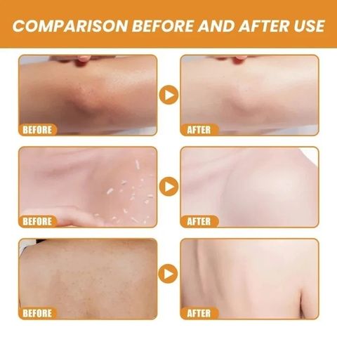 Tẩy tế bào chết body Dưỡng trắng da body Tẩy Tế Bào Chết Toàn Thân 50g tẩy tế bào chết, Làm sáng da màu