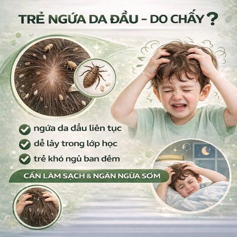 Dầu Gội Diệt Chấy Hữu Cơ Puressentiel PouxDoux Organic Shampoo Ngăn Ngừa Chấy Cho Bé & Gia Đình 200ml