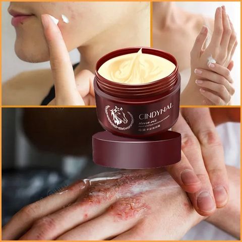 Foot care /Whitening repair foot cream Kem Bôi Ngựa Nứt Gót Chân Nẻ Tay Chân Á Sừng Bong Da Hiệu Quả/110g 631848