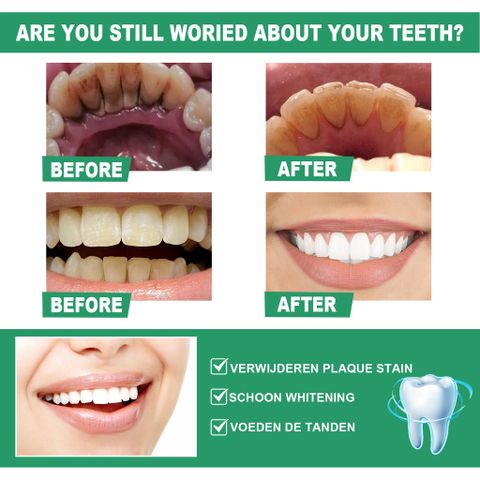 Bột Đánh Trắng Răng - Hạt Siêu Mịn Không Mòn Men - Cam Kết Trắng Bật Tông
