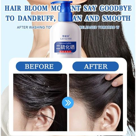 Dầu gội sạch gàu Dầu Gội gội loại bỏ mạt dầu gội giảm ngứa 300ml Làm sạch sâu da đầu, loại bỏ ve, loại