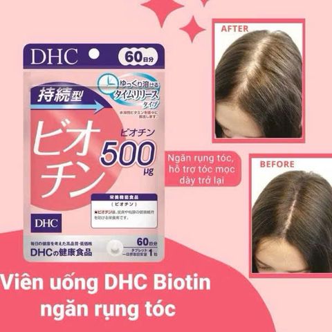(Nhật) Viên Uống DHC Biotin Hỗ Trợ Mọc Tóc Giảm Rụng Tóc