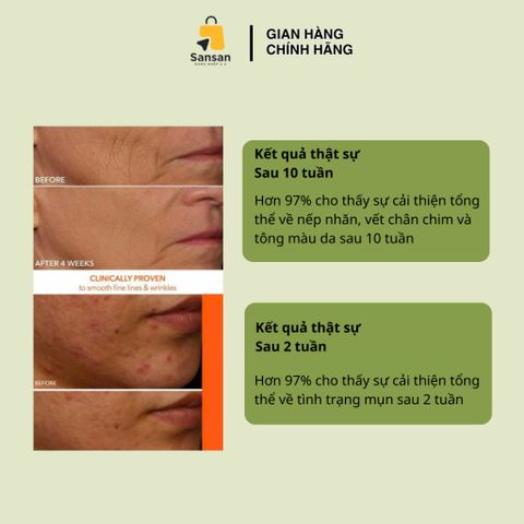 Mặt nạ ánh sáng LED Dr Dennis Gross DRx SpectraLite FaceWare Pro - Mỹ