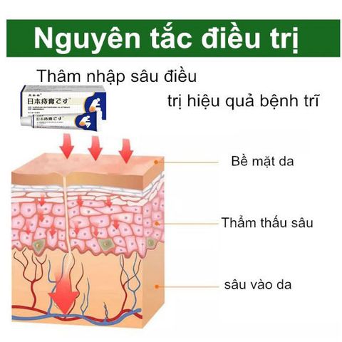 Nhật Bản Kem thảo dược bôi trĩ co búi trĩ giảm đau do trĩ