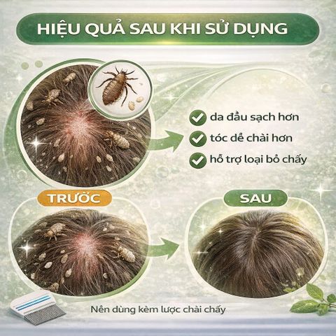 Dầu Gội Hữu Cơ Hằng Ngày Puressentiel PouxDoux Organic Shampoo Ngăn Ngừa Chấy Cho Bé Gia Đình 200ml