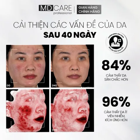 MD CARE NMF Prebiotics Serum 30ml Tinh Chất Cấp Ẩm Và Cân Bằng Hệ Vi Sinh Trên Da