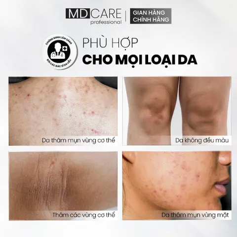 [CHÍNH HÃNG] Kem Dưỡng Sáng Chuyên Biệt MD CARE Brightening Blemish Cream 50ml