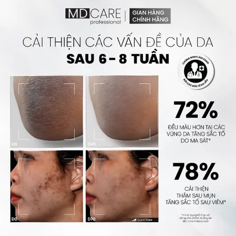 [CHÍNH HÃNG] Kem Dưỡng Sáng Chuyên Biệt MD CARE Brightening Blemish Cream 50ml