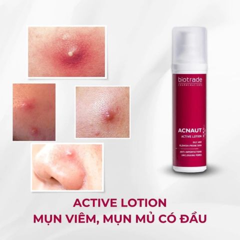 Lotion chấm mụn hoạt tính Biotrade Acnaut Active Lotion
