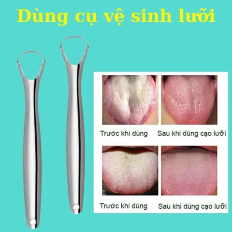 Bộ dụng cụ vệ sinh lưỡi bằng inox 304, làm sạch bề mặt lưỡi giúp hơi thở thơm mát dùng được cho trẻ nhỏ