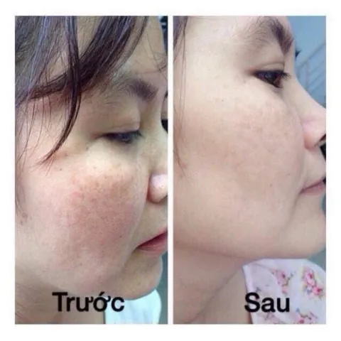 Viên uống Glutathion KD hỗ trợ trắng da,giảm nám,đồi mồi cho da (Hộp 30 viên)