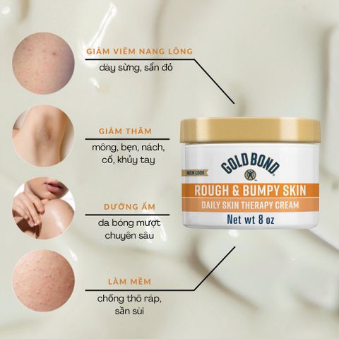 Kem dưỡng da body Gold Bond Ultimate Rough và Bumpy Skin 226g - Mỹ