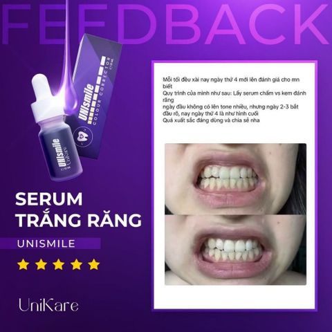 Serum Trắng Răng Unismile 10ml – Tinh Chất Làm Trắng Răng, Hỗ Trợ Giảm Ố Vàng, Làm Sạch Mảng Bám