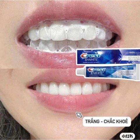 🦷🦷KEM ĐÁNH RĂNG CREST MỸ 𝟑D MẪU MỚI NHẤT SẠCH, THƠM & TRẮNG HƠN