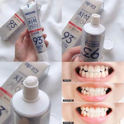 Kem Đánh Răng Median Dental IQ 93% (Màu Ngẫu Nhiên)